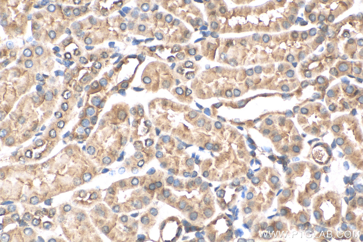 IHC staining of mouse kidney using 13947-1-AP