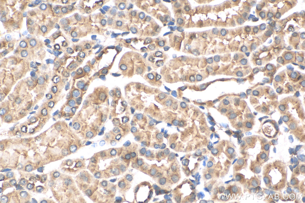 IHC staining of mouse kidney using 13947-1-AP