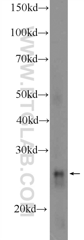 WB analysis of mouse kidney using 13947-1-AP