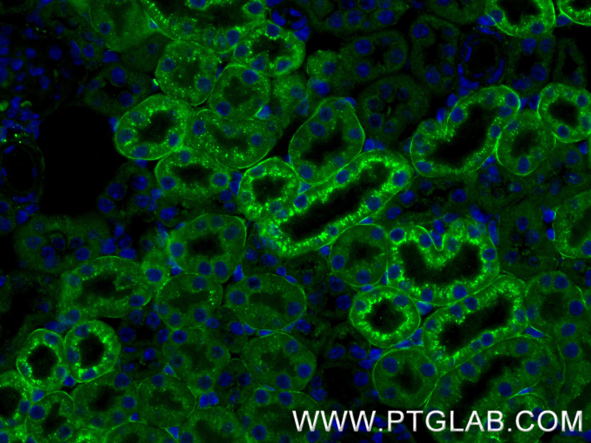 IF Staining of mouse kidney using 86650-2-RR IF Staining of mouse kidney using 86650-2-RR
