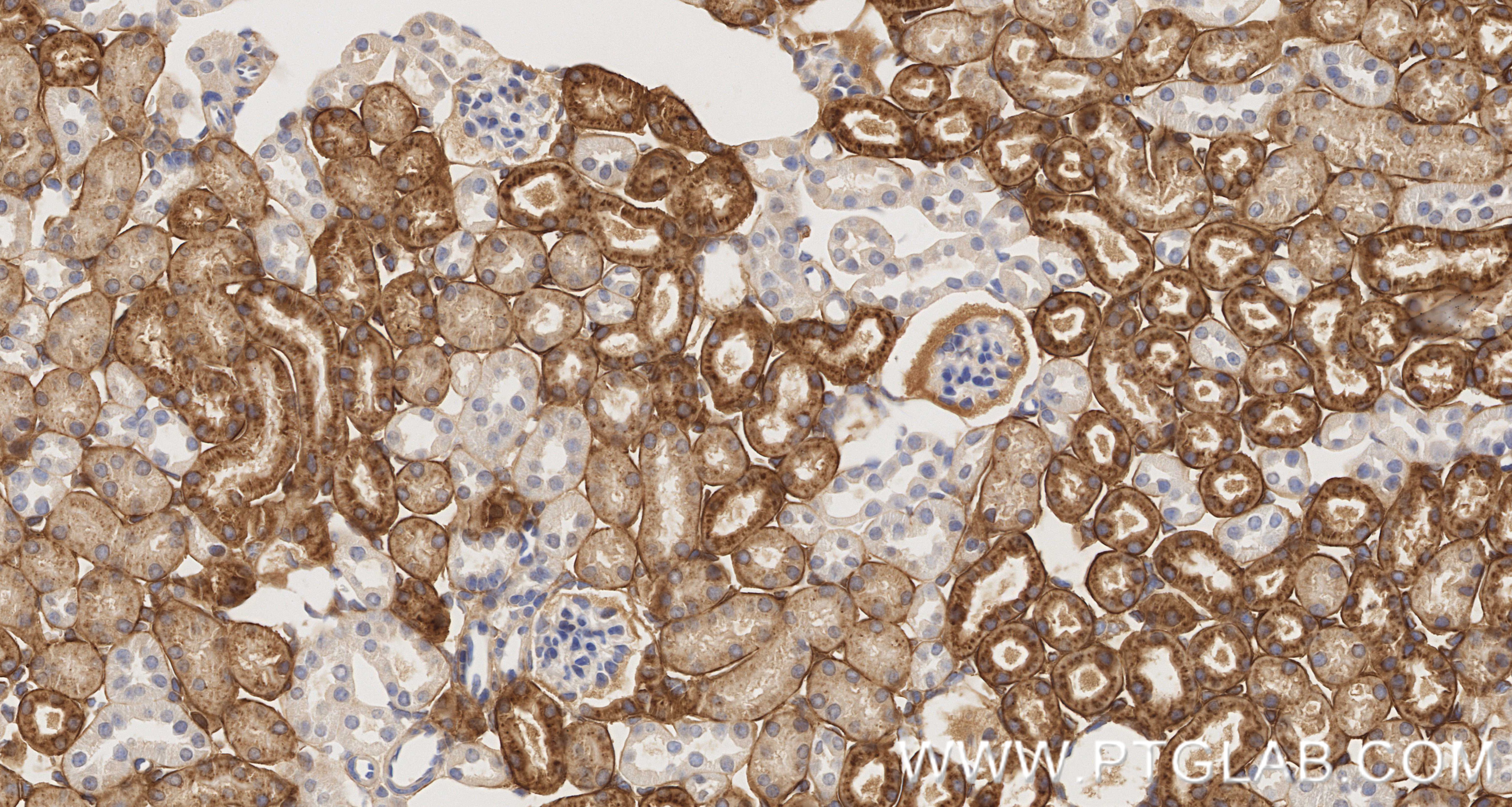 IHC staining of mouse kidney using 86650-2-RR IHC staining of mouse kidney using 86650-2-RR