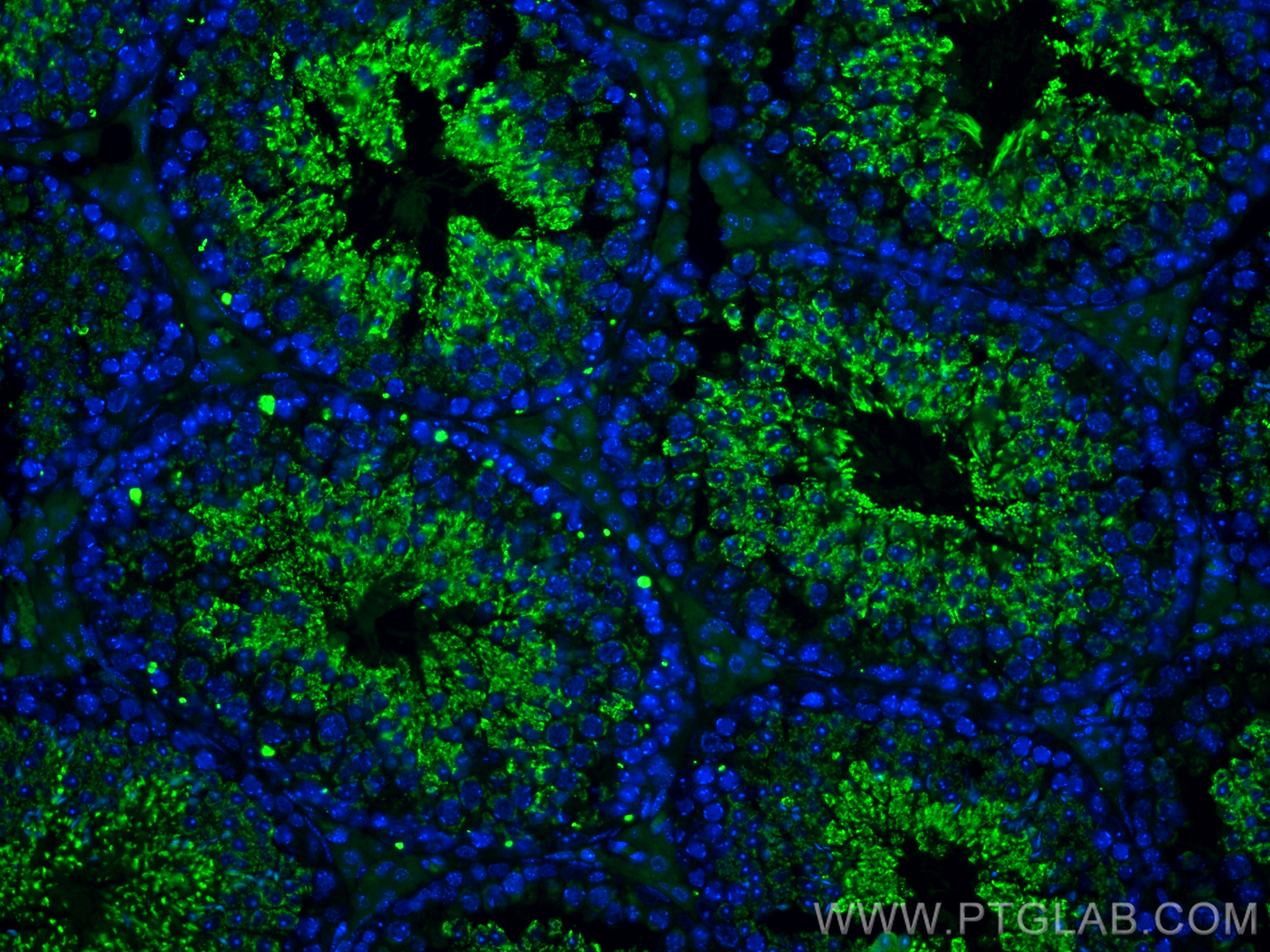IF Staining of mouse testis using 67763-1-Ig