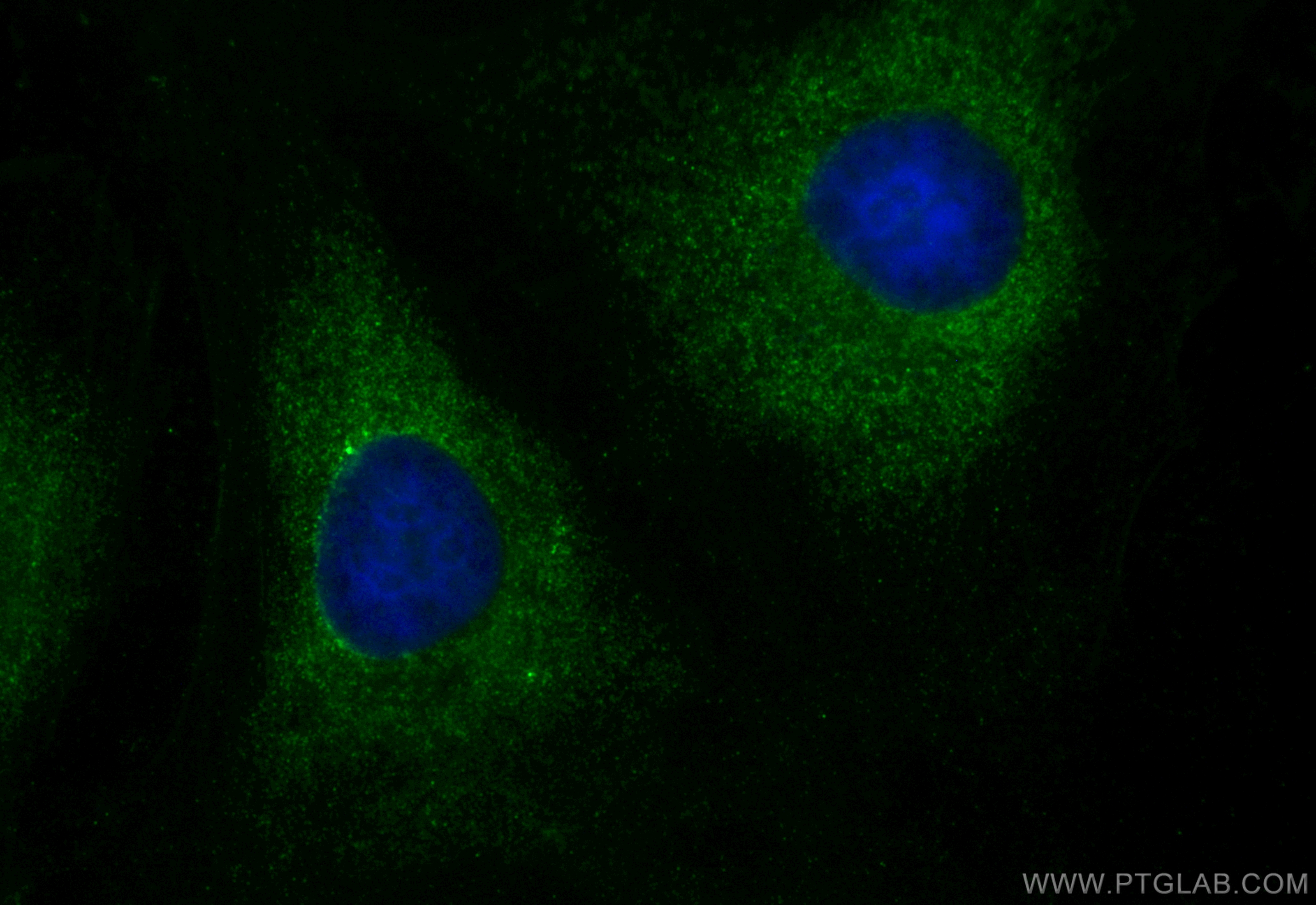IF Staining of HeLa using CL488-30388