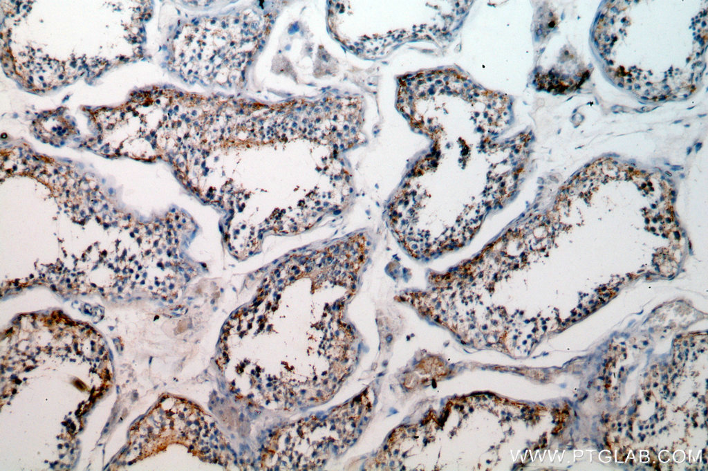 IHC staining of human testis using 18731-1-AP