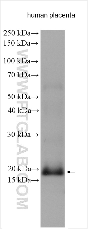 WB analysis using 13501-1-AP