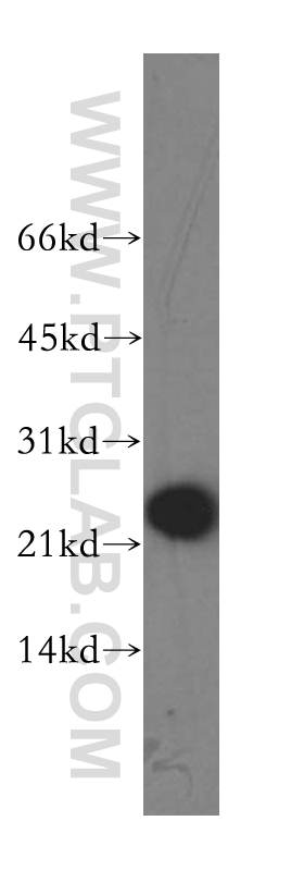 WB analysis of human liver using 13501-1-AP