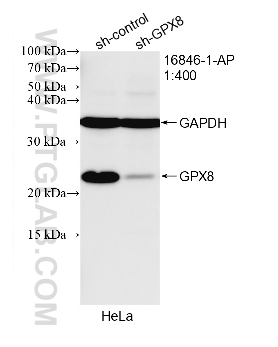 WB analysis of HeLa using 16846-1-AP WB analysis of HeLa using 16846-1-AP