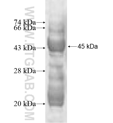 GPX8 fusion protein Ag10113 SDS-PAGE GPX8 fusion protein Ag10113 SDS-PAGE