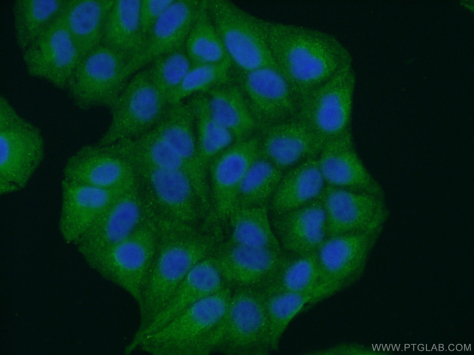 IF Staining of A549 using 24905-1-AP (same clone as 24905-1-PBS)
