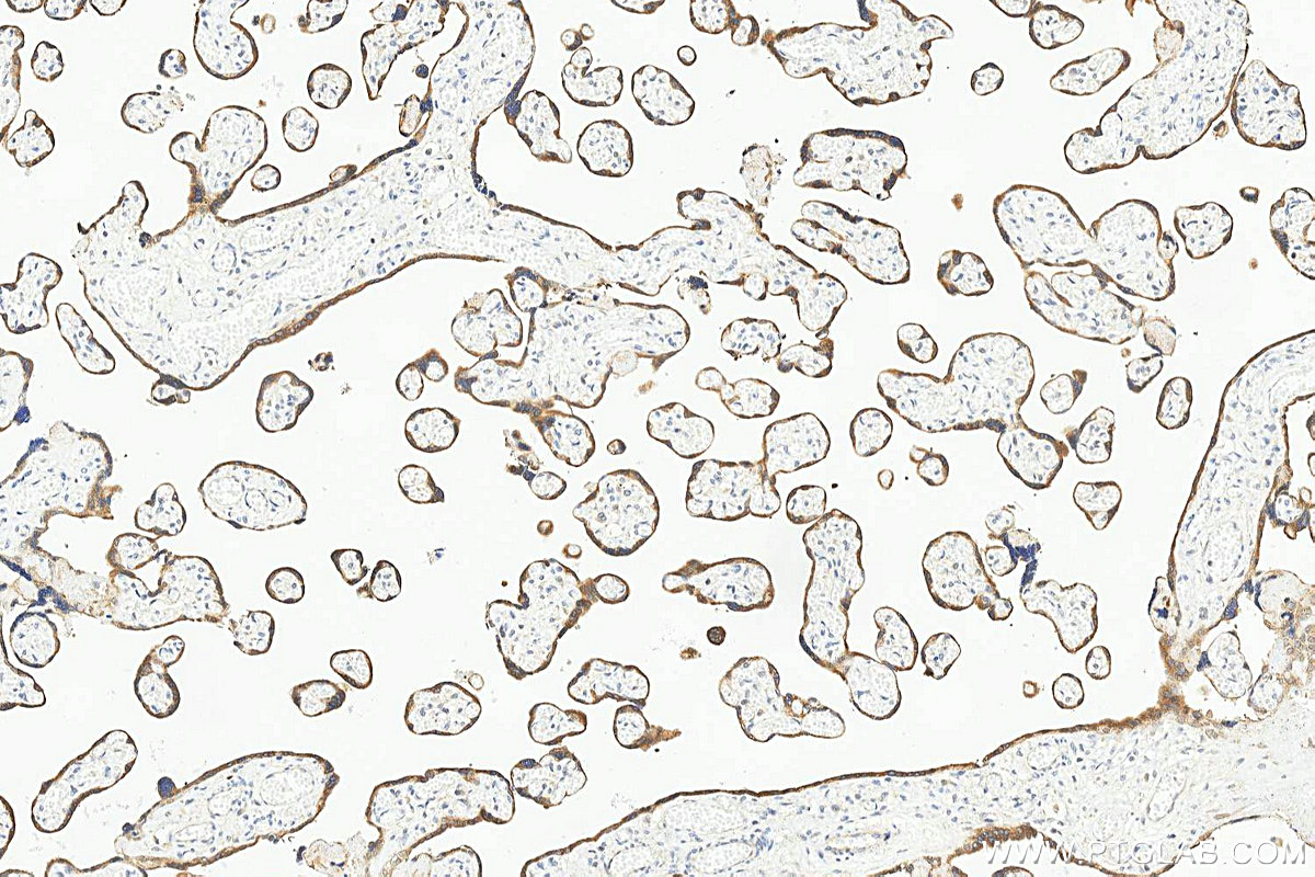 IHC staining of human placenta using 25545-1-AP IHC staining of human placenta using 25545-1-AP