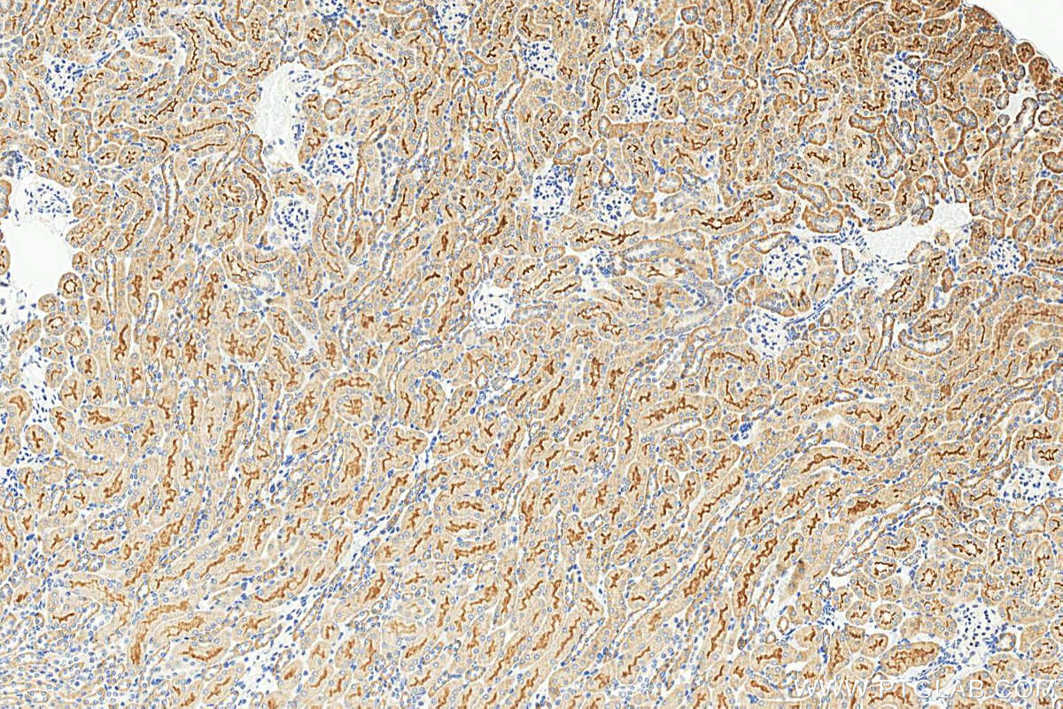 IHC staining of mouse kidney using 25545-1-AP IHC staining of mouse kidney using 25545-1-AP