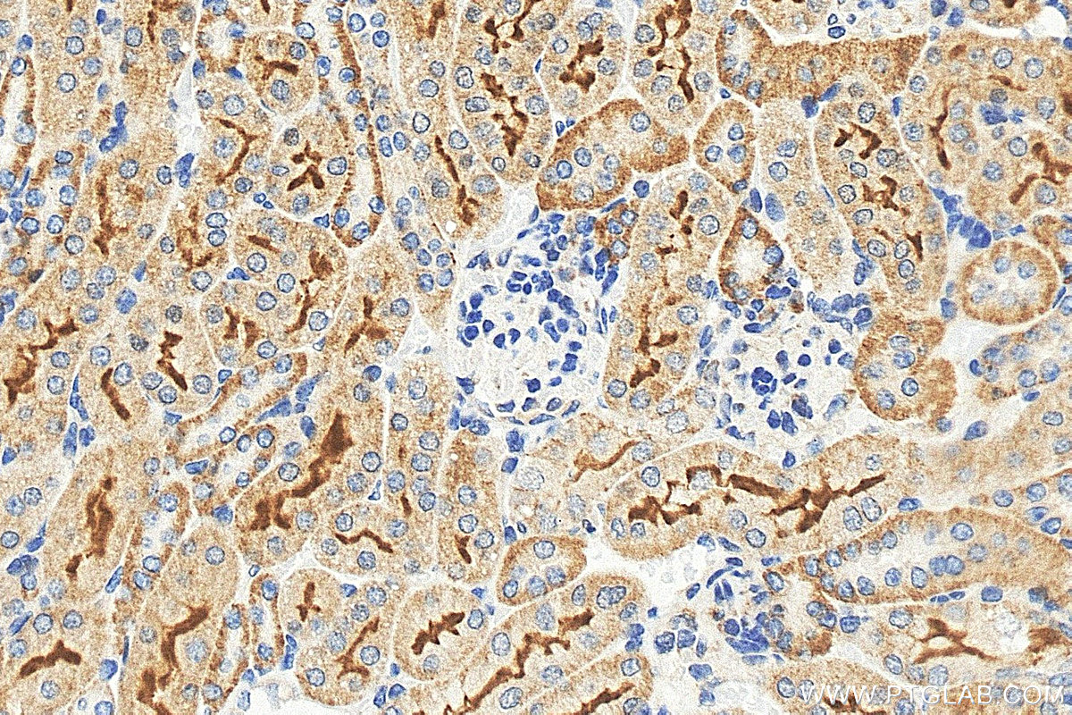 IHC staining of mouse kidney using 25545-1-AP IHC staining of mouse kidney using 25545-1-AP