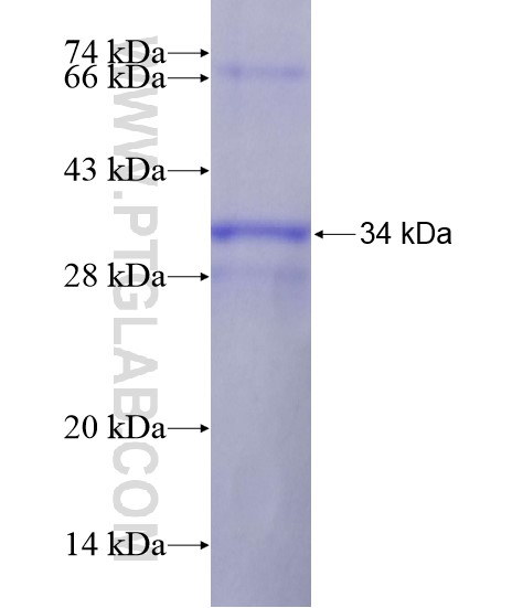 GRAMD4 fusion protein Ag19508 SDS-PAGE GRAMD4 fusion protein Ag19508 SDS-PAGE