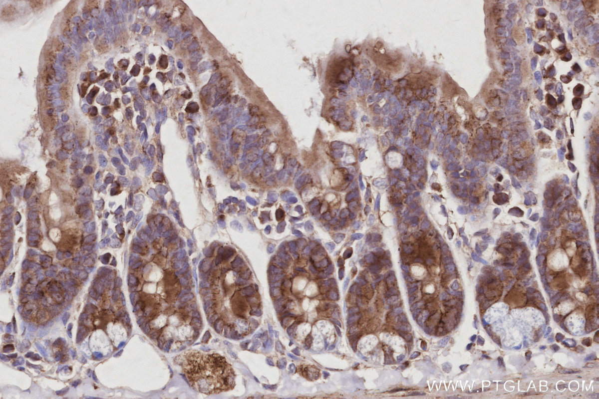 IHC staining of mouse small intestine using 10747-2-AP IHC staining of mouse small intestine using 10747-2-AP