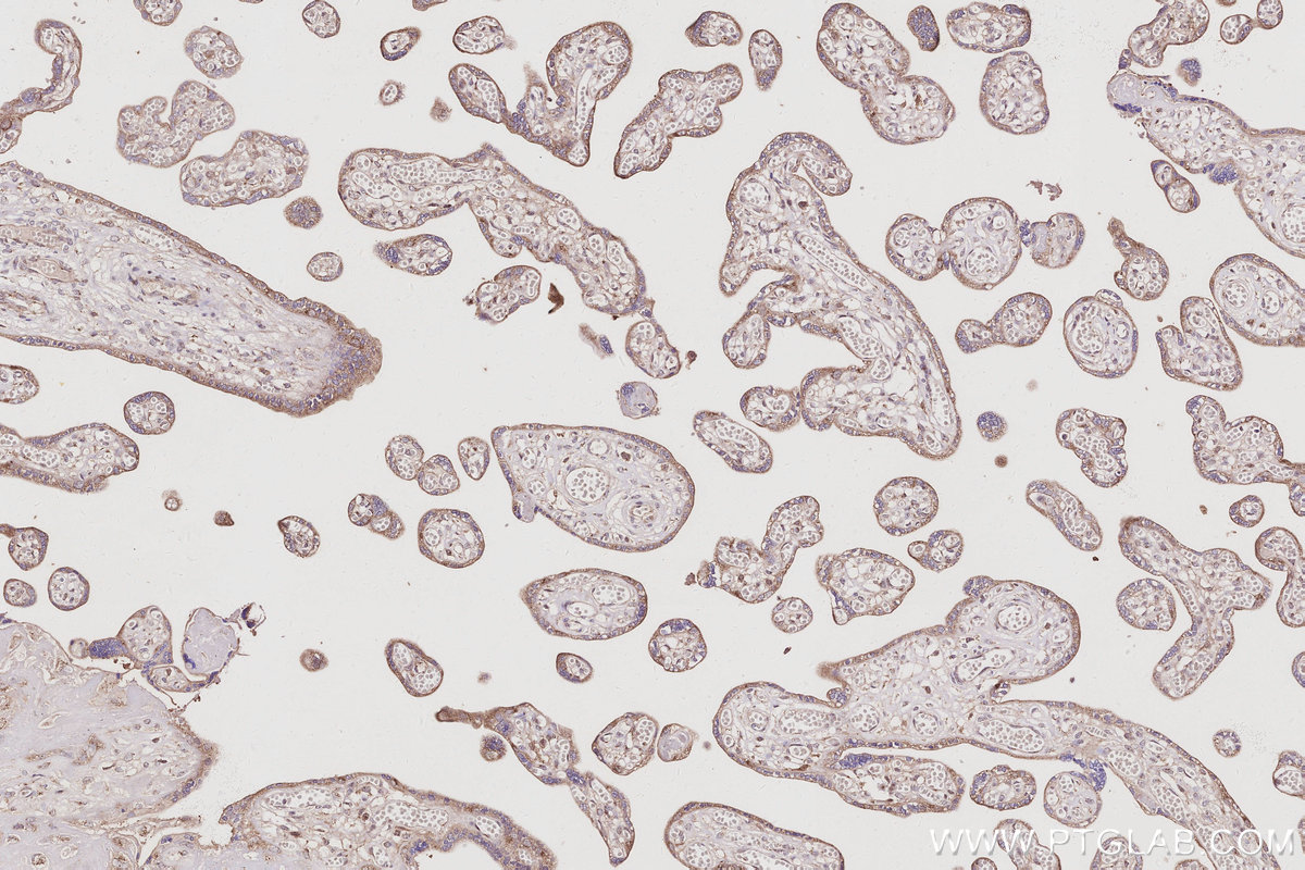 IHC staining of human placenta using 10747-2-AP IHC staining of human placenta using 10747-2-AP