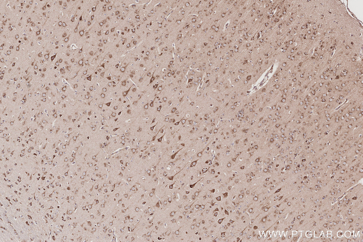 IHC staining of rat brain using 10747-2-AP IHC staining of rat brain using 10747-2-AP