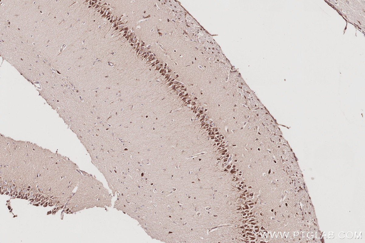 IHC staining of rat brain using 10747-2-AP IHC staining of rat brain using 10747-2-AP