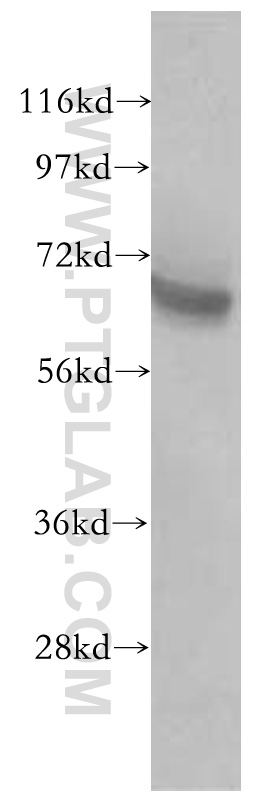 WB analysis of mouse brain using 10027-2-AP