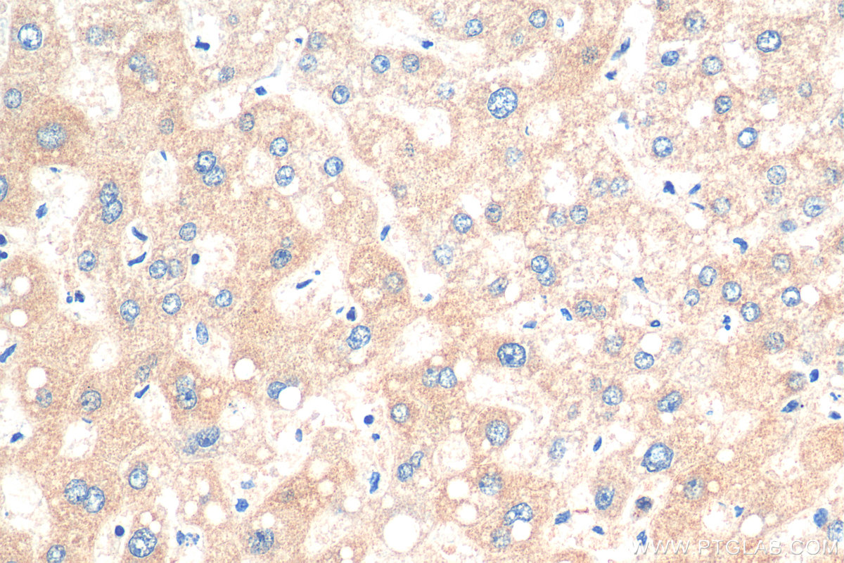 IHC staining of human liver using 28872-1-AP