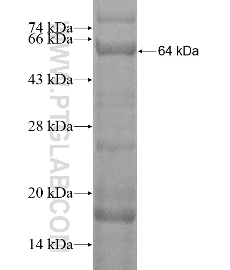 GRB10 fusion protein Ag20362 SDS-PAGE GRB10 fusion protein Ag20362 SDS-PAGE