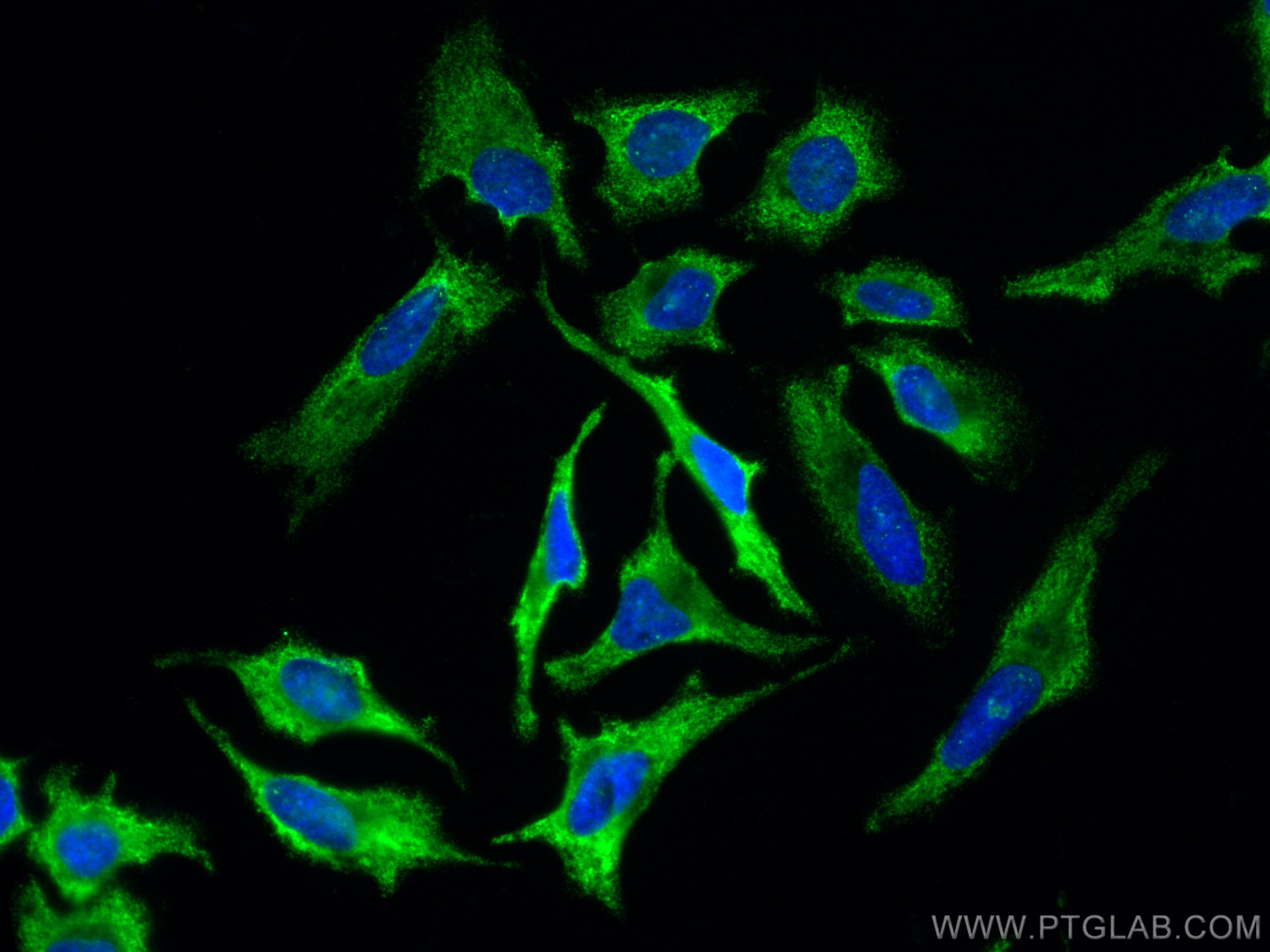 IF Staining of HeLa using CL488-66880