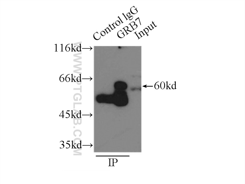 IP experiment of A431 using 10045-1-Ig