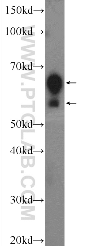 WB analysis of HEK-293 using 10045-1-Ig