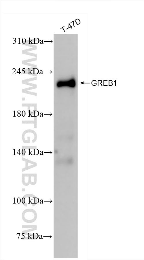 WB analysis of T-47D using 85189-4-RR (same clone as 85189-4-PBS)