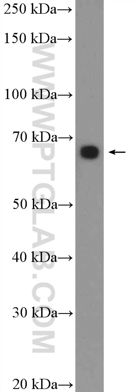 NCCIT cell were subjected to SDS PAGE followed by western blot with 17644-1-AP (GRHL1 Antibody) at dilution of 1:300  incubated at room temperature for 1.5 hours. WB analysis of NCCIT using 17644-1-AP