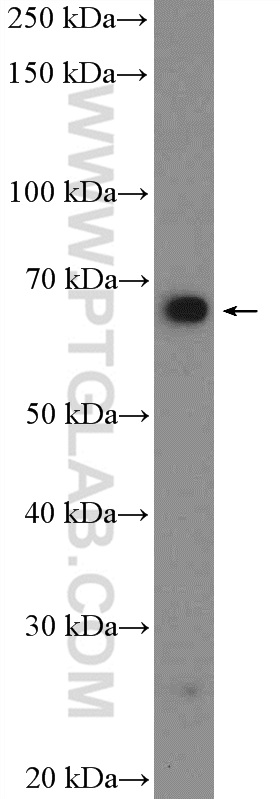 GRHL1