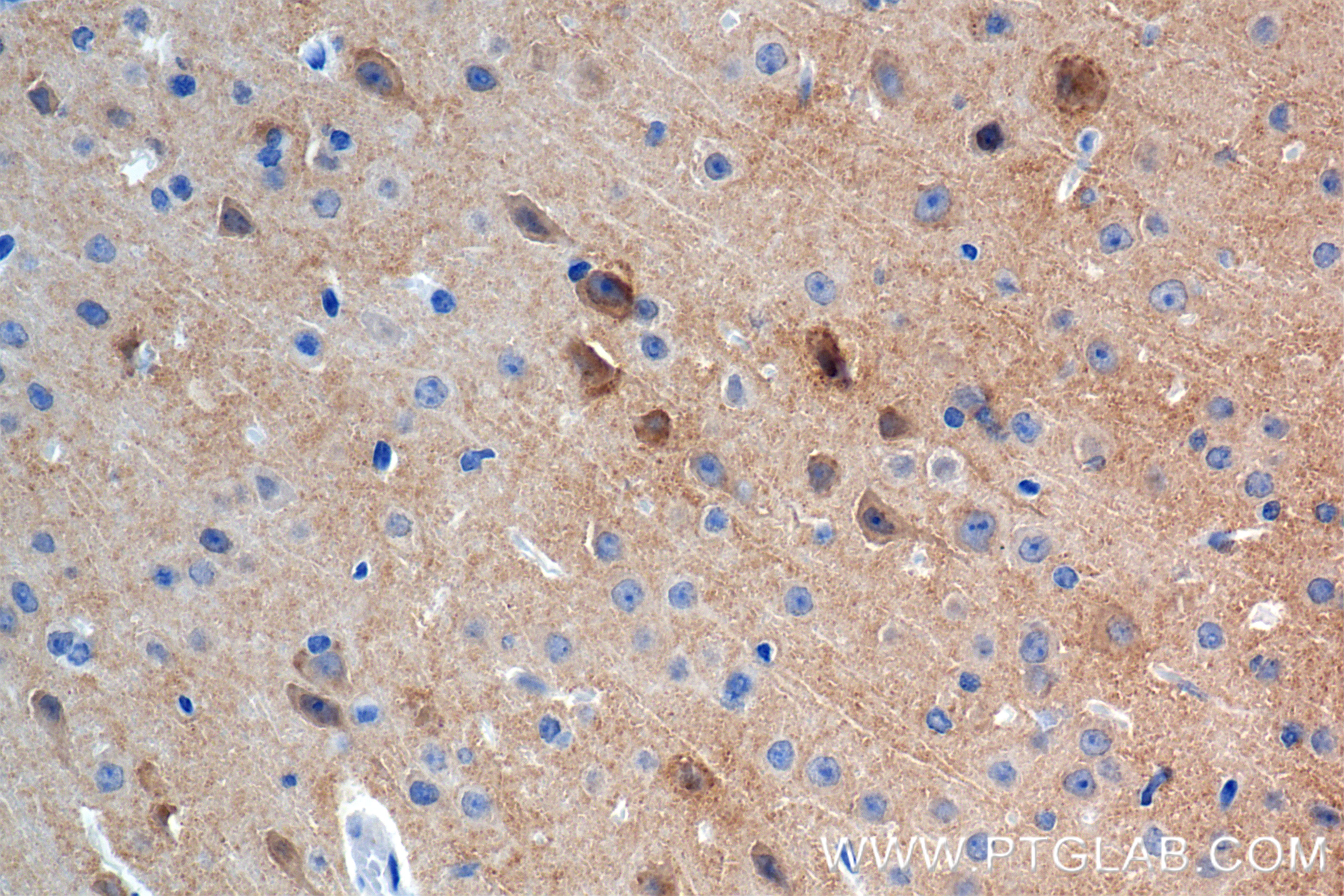 IHC staining of mouse brain using 85333-1-RR