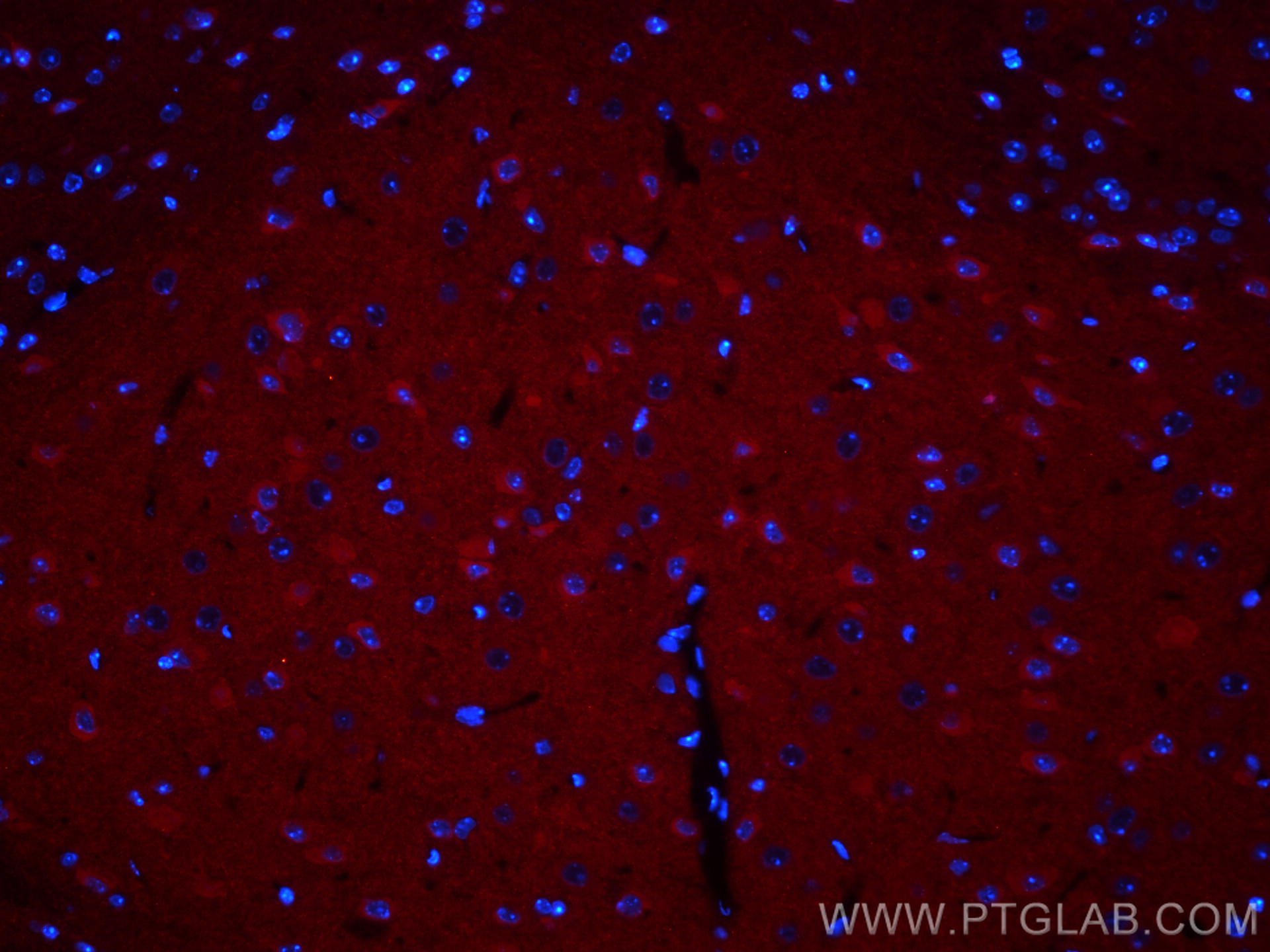 IF Staining of mouse brain using CL594-67642