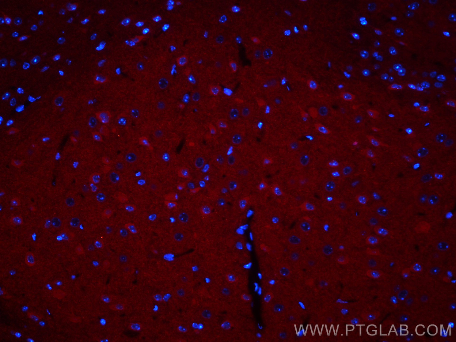 IF Staining of mouse brain using CL594-67642