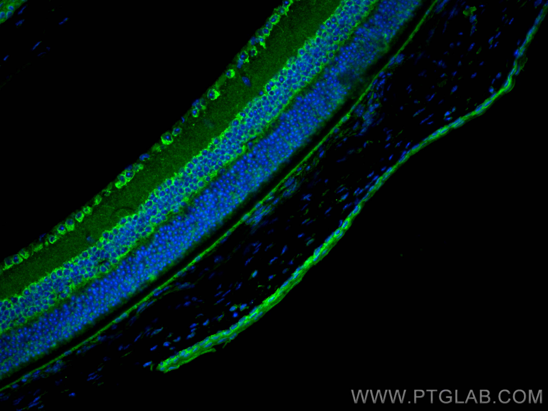 IF Staining of mouse eye using 11994-1-AP
