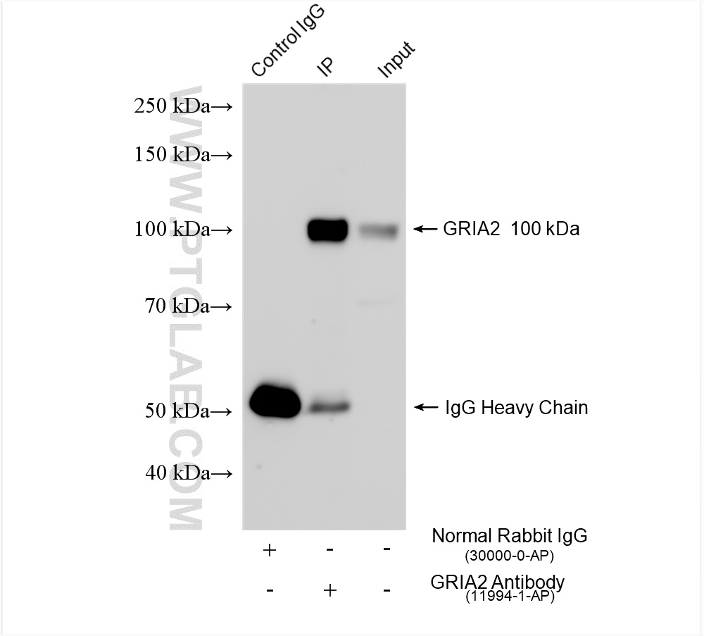 IP experiment of mouse brain using 11994-1-AP