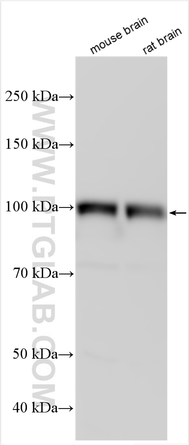 WB analysis using 11994-1-AP