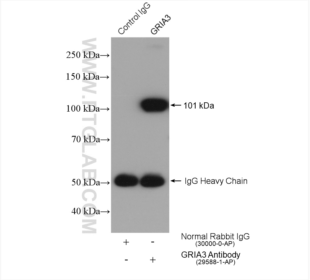 Glutamate receptor 3/GluA3
