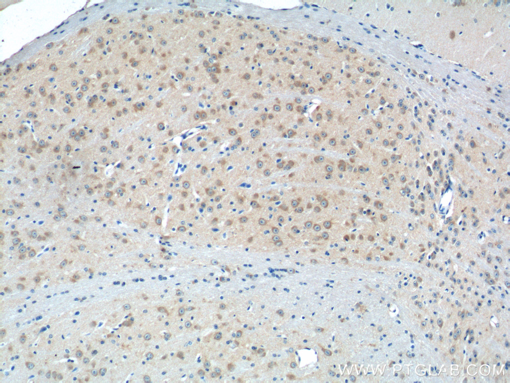 IHC staining of mouse brain using 23350-1-AP