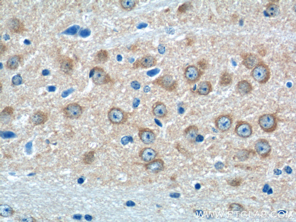 IHC staining of mouse brain using 23350-1-AP