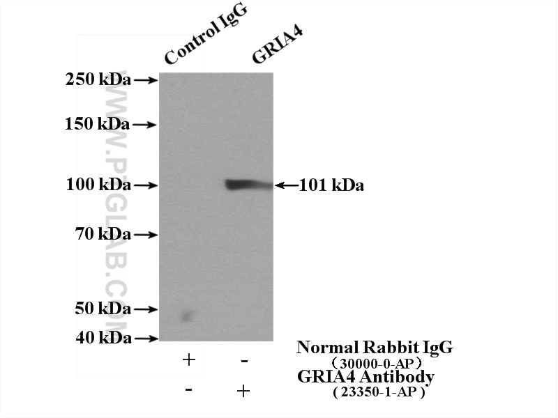 IP experiment of mouse brain using 23350-1-AP