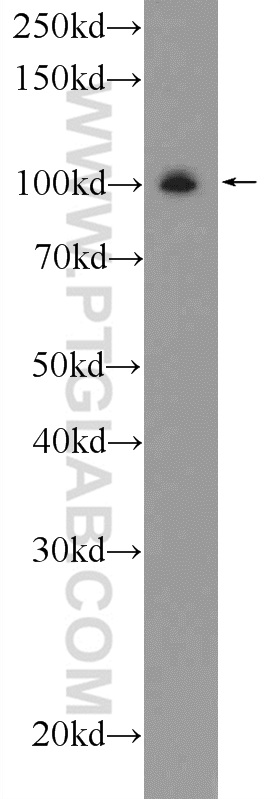 WB analysis of rat brain using 23350-1-AP