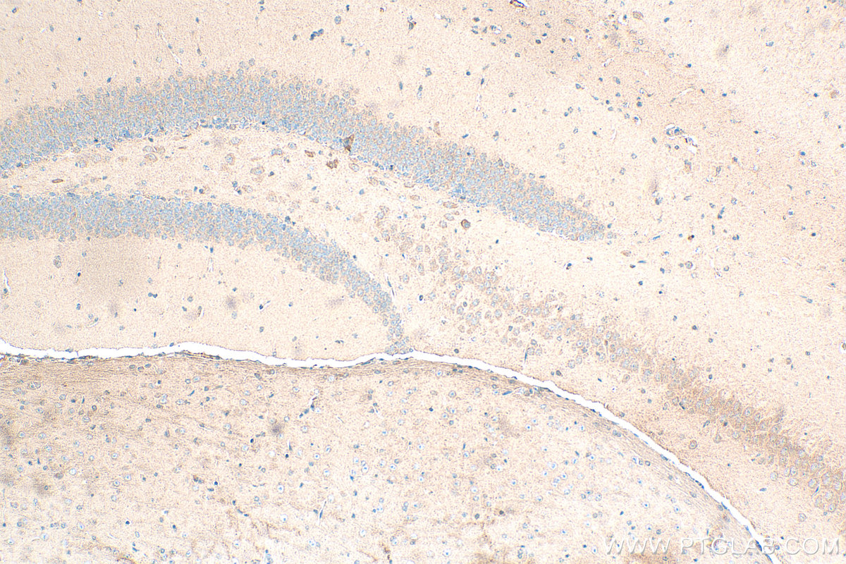 Immunohistochemical analysis of paraffin-embedded mouse brain tissue slide using 13040-1-AP (GRID1 antibody) at dilution of 1:200 (under 10x lens). Heat mediated antigen retrieval with Tris-EDTA buffer (pH 9.0). IHC staining of mouse brain using 13040-1-AP