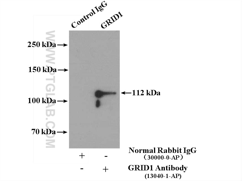 IP experiment of mouse brain using 13040-1-AP