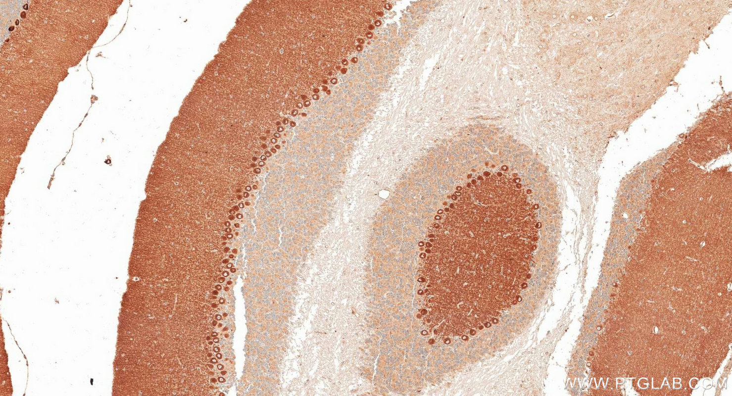 IHC staining of mouse cerebellum using 21727-1-AP IHC staining of mouse cerebellum using 21727-1-AP