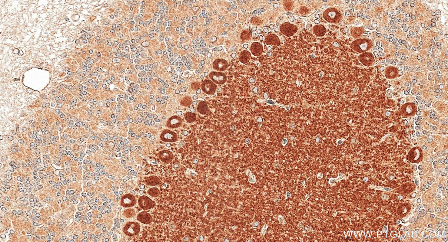 IHC staining of mouse cerebellum using 21727-1-AP IHC staining of mouse cerebellum using 21727-1-AP