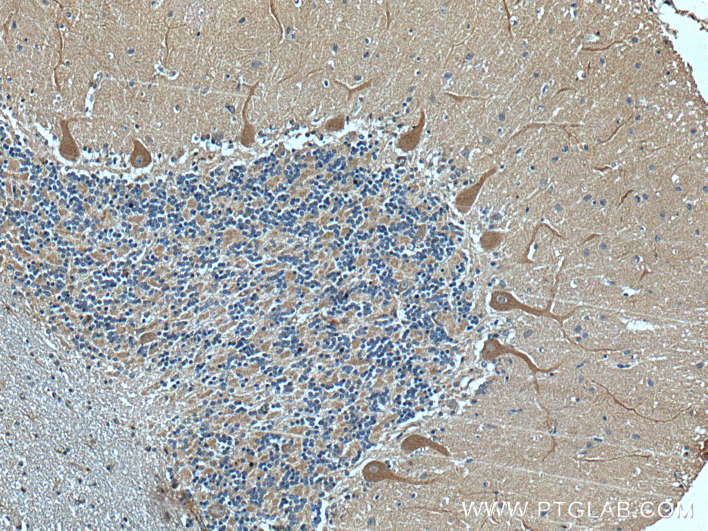 IHC staining of human cerebellum using 25779-1-AP