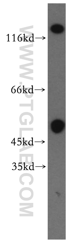 GRIK2 Polyclonal antibody