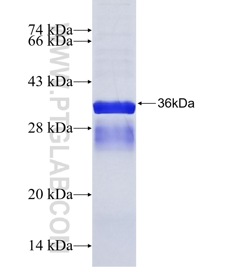 GRIK4 fusion protein Ag15574 SDS-PAGE GRIK4 fusion protein Ag15574 SDS-PAGE