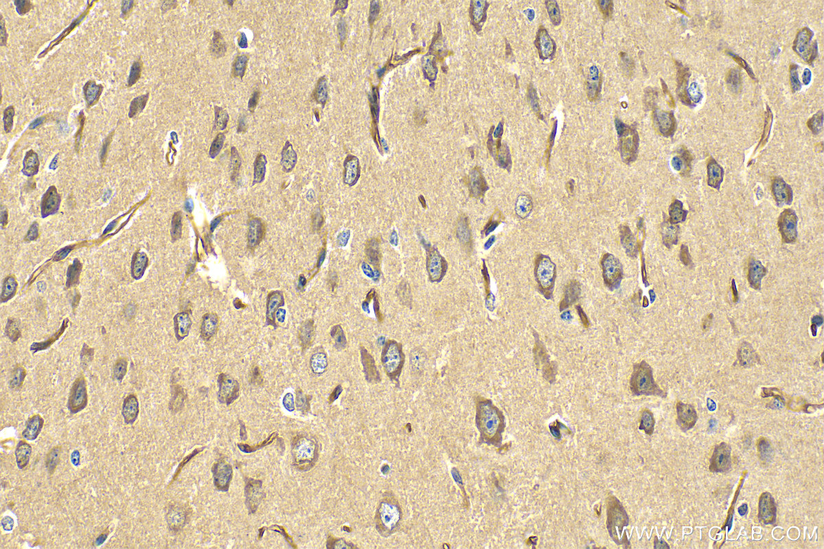 IHC staining of mouse brain using 28550-1-AP (same clone as 28550-1-PBS)
