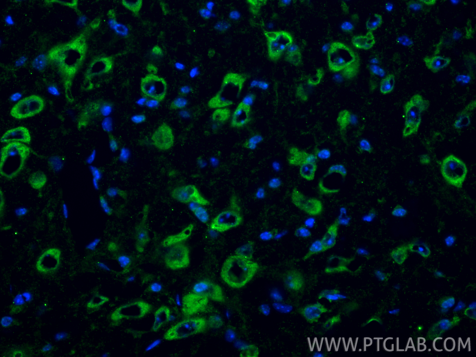 Immunofluorescent analysis of (4% PFA) fixed frozen OCT-embedded mouse brain tissue using NMDAR1/GRIN1 antibody (27676-1-AP) at dilution of 1:200 and CoraLite®488-Conjugated Goat Anti-Rabbit IgG(H+L) (<a class='green' href='/productredirect?CatalogNo=SA00013-2' target='_blank'>SA00013-2</a>). IF Staining of mouse brain using 27676-1-AP